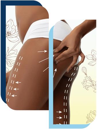 augmentation fesses tunisie